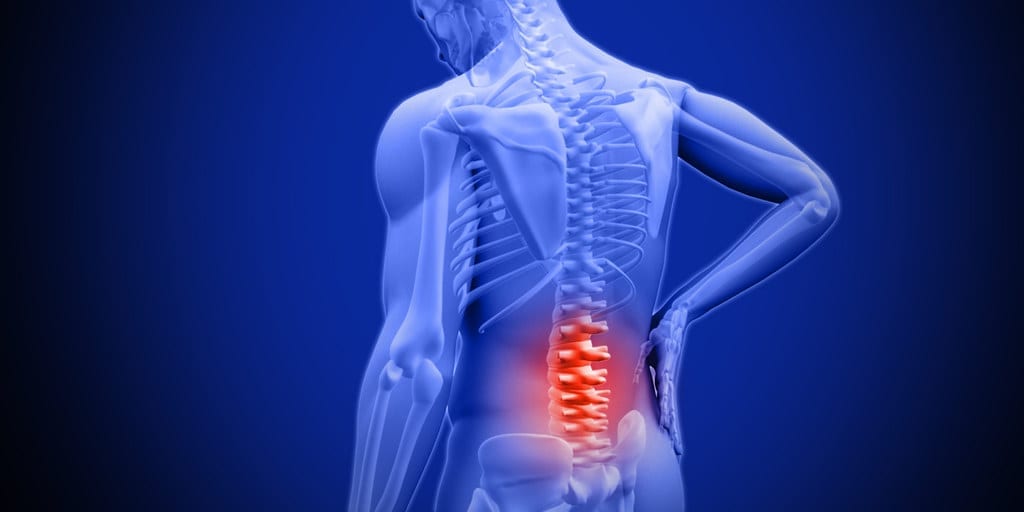 cannabis for chronic back pain