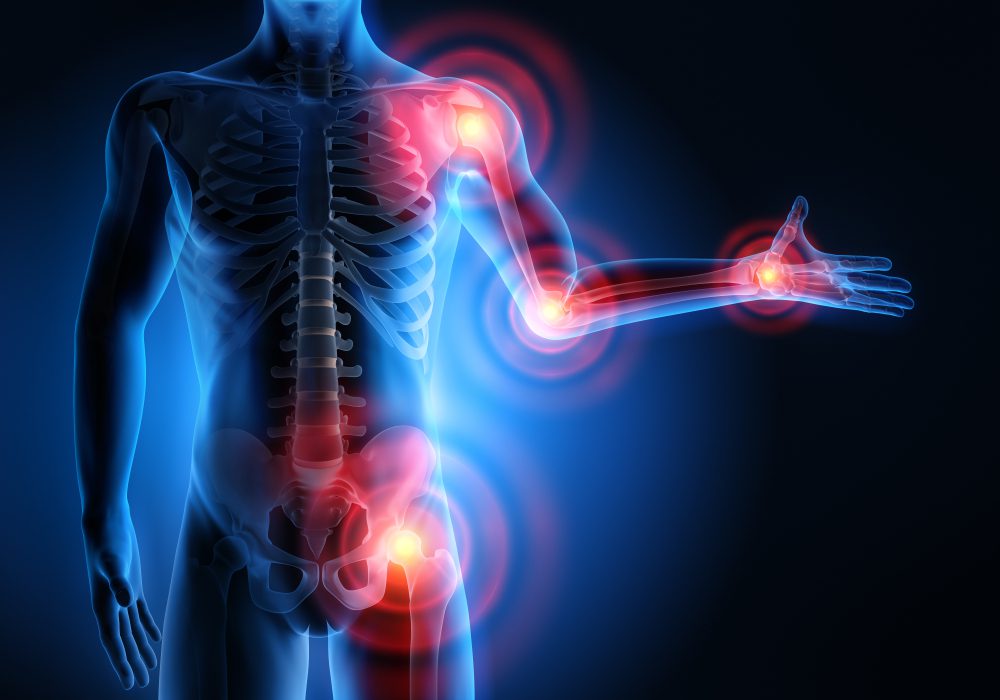 Painful,Joints,-,3d,Illustration